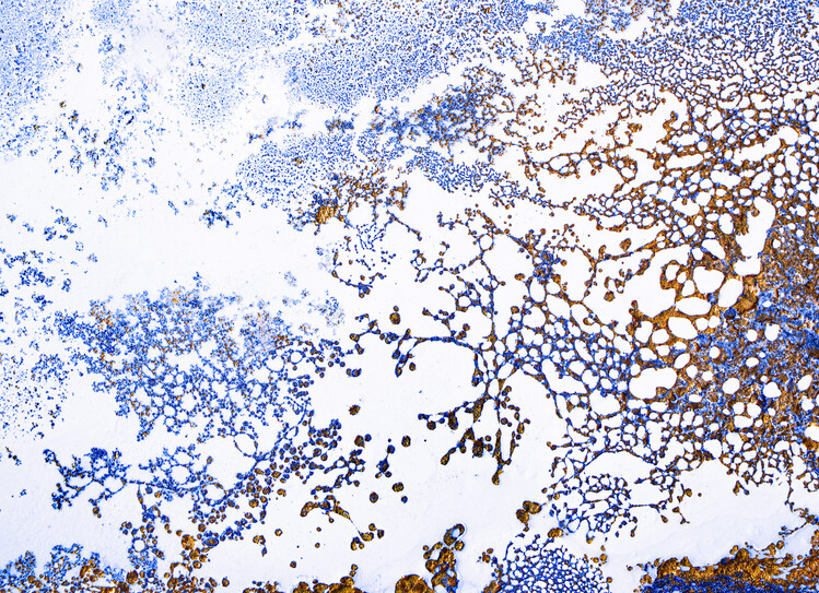 Plakat Coral Blooming